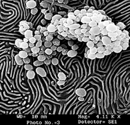 electron microscopy aiims